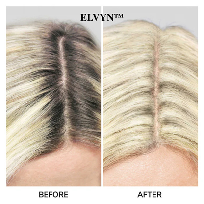 ELVYN™ Haaransatz Touch-Up Puderpinsel