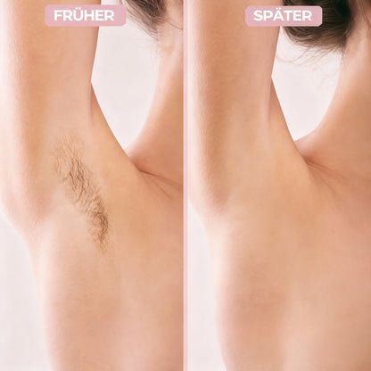 Soie | 2-in-1 SmoothShaver