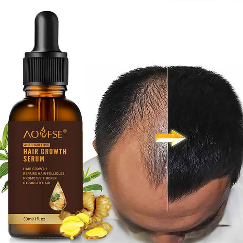 FollicleFuel™ - Das Haarwachstumsserum, das tote Follikel wieder zum Leben erweckt