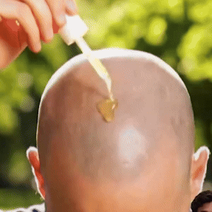 FollicleFuel™ - Das Haarwachstumsserum, das tote Follikel wieder zum Leben erweckt